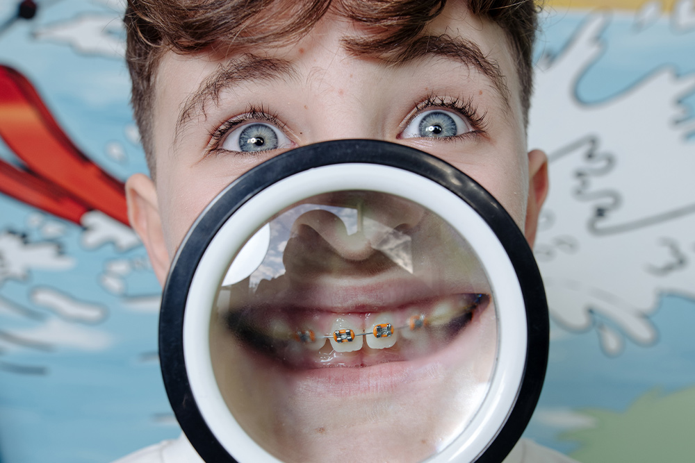 Bambino con il primo apparecchio per i denti, installato presso lo Studio Medico Dentistico Santa Apollonia