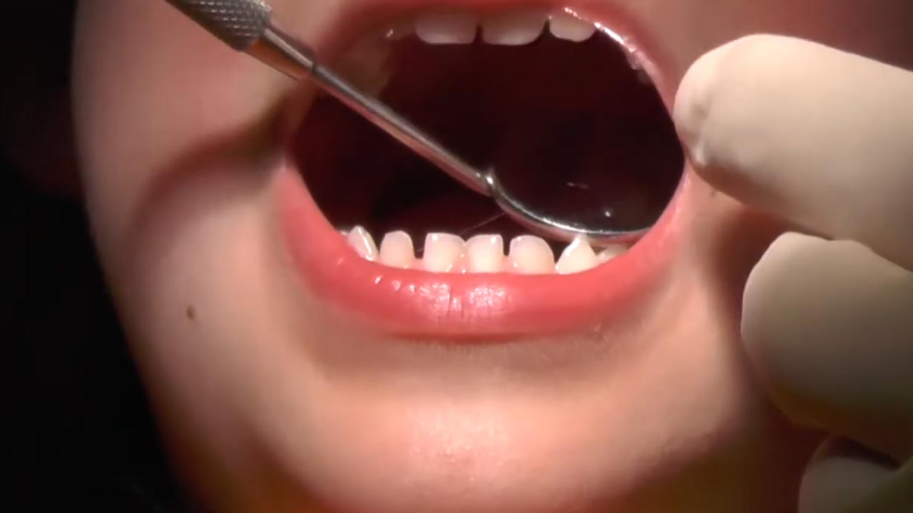 Sant_apollonia_cura_denti_da_latte